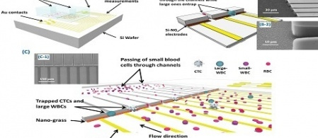 Nanoelectromechanical Chip (NELMEC) Combination of Nanoelectronics and Microfl uidics to Diagnose Epithelial and Mesenchymal Circulating Tumor Cells from Leukocytes