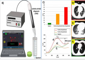 Iranian scientists[Institute of Cancer and the University of Tehran ] develop system for real-time diagnosis of COVID-19