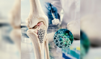 Smart Biological Scaffolds Designed and Fabricated at the University of Tehran