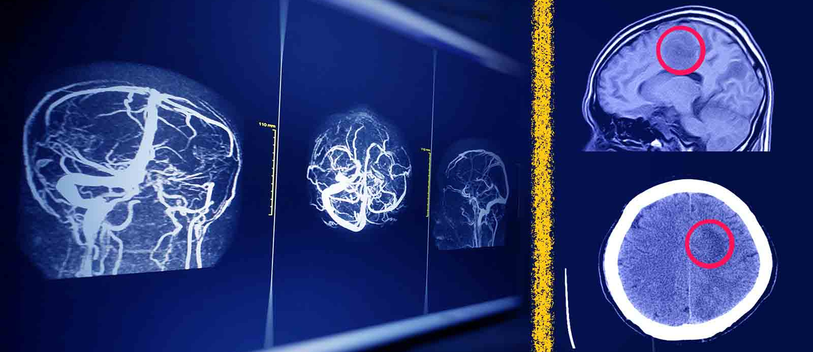 راه‌ حل جدید پژوهشگران دانشگاه تهران برای افزایش امنیت هوش مصنوعی در تحلیل MRI مغز